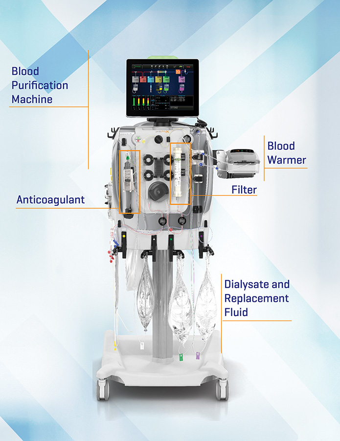 Graphic of the different components of a CRRT blood purification system